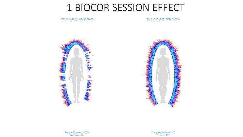 GDV Biocor effect, 1 session