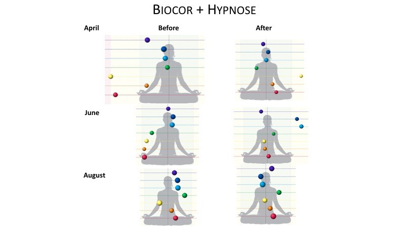 GDV Biocor effect, Bio-Cor+Hypnosis
