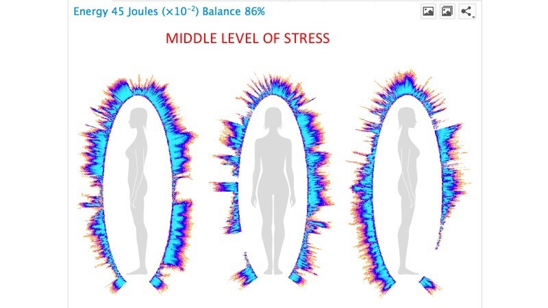 Middle level of Stress BioField, Korotkov's images