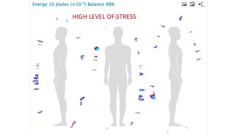High level of Stress BioField, Korotkov's images