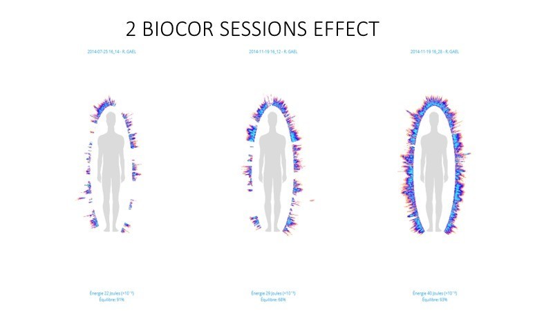 GDV Biocor effect, 2 sessions